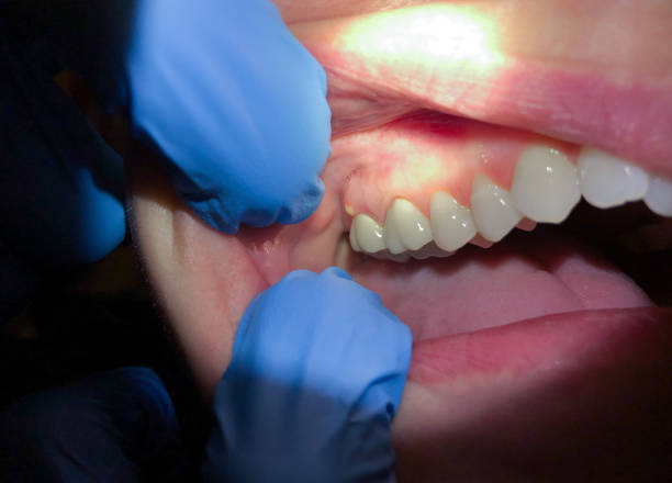 Best Emergency Treatment for Jaw Pain or Injury in Valley Stream, NY